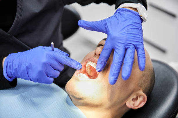 Best Emergency Wisdom Teeth Removal in Callaway, MD